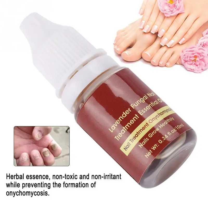 10ml Fungal Nail Treatment Essential oil Hand and Foot Whitening Toe Nail Fungus Removal