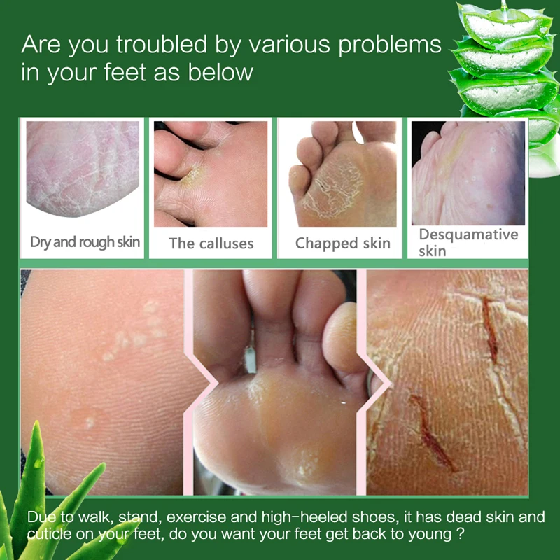 Beli Efero 1 Pair = 2 Pcs Kaki Bayi Pengelupasan Kulit Mati Retak Tumit Kaki Masker Peeling Kaus Kaki untuk Pedikur kaki Mengelupas Masker untuk Kaki