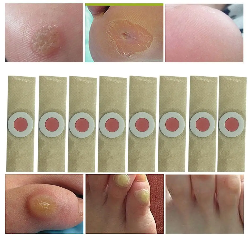 50 piezas de yeso de maíz sin dolor removedor de maíz pies cuidado de color caqui verrugas parche de yeso de espino para pies 50 piezas de yeso de maíz sin dolor removedor de maíz pies cuidado de color caqui verrugas parche de yeso de espino para pies