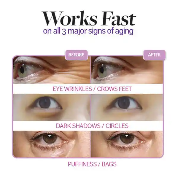 freezeframe revitaleyes