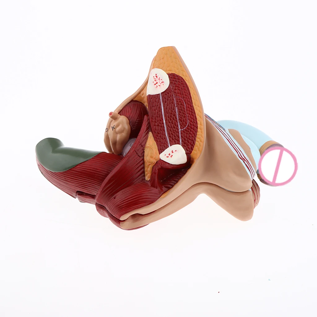 1:1 Male Genital Testis Scrotum Anatomical Model Genitourinary Medicine School Student Teacher Teaching Aids Lab Supplies