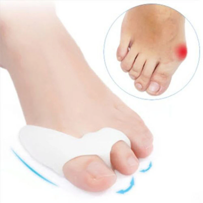 

2Pair Exfoliation Feet Pad Bone Ectropion Toes Outer Appliance Hallux Valgus Silica Gel Toe Separator Foot Care Toe Straightener