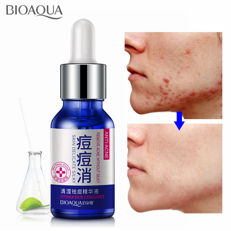 

Anti Acne Serum Remove Blackhead Eliminates Scar Acne Treatment Moisturizing Oil Control Shrink Pore Pimple Blemish Essence 30ML