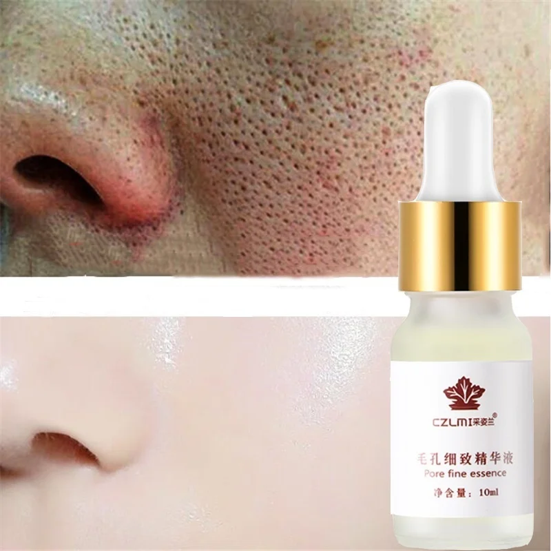 

Pore Treatment Serum Essence Shrink Pores Relieve Dryness Oil Control Firming Moisturizing Repairing Smooth Skin Care