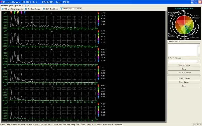 CONTEC8000G Многофункциональный ПК ECG/EKG рабочая станция система 12 свинец отдыха ECG