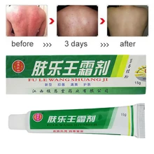 1 psoríase creme massagem corporal remendos dermatite e eczema pruritus psoríase pomada dropshipping & atacado