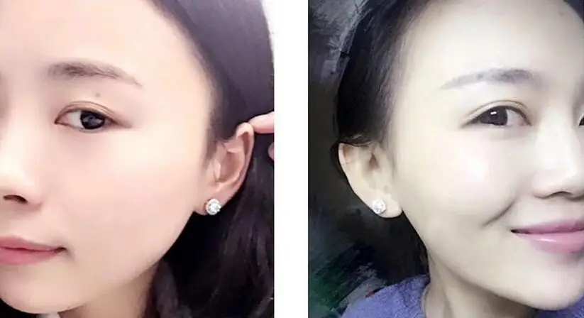 QQ20170311084418