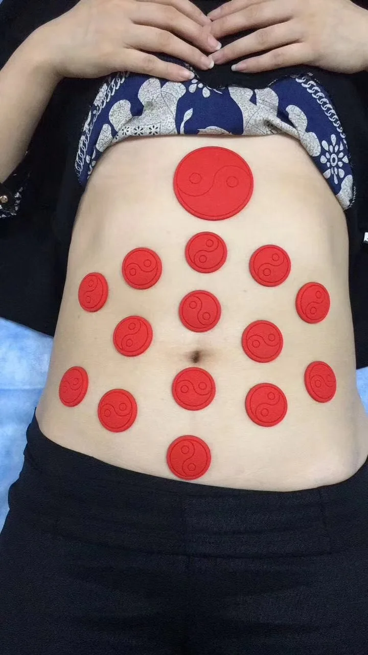 Natural silicone Rubber Self heating Sticker Therapy Health Care massage Hot Sticker Acupunture Vacuum cans suction cup Natural silicone Rubber Self heating Sticker Therapy Health Care massage Hot Sticker Acupunture Vacuum cans suction cup
