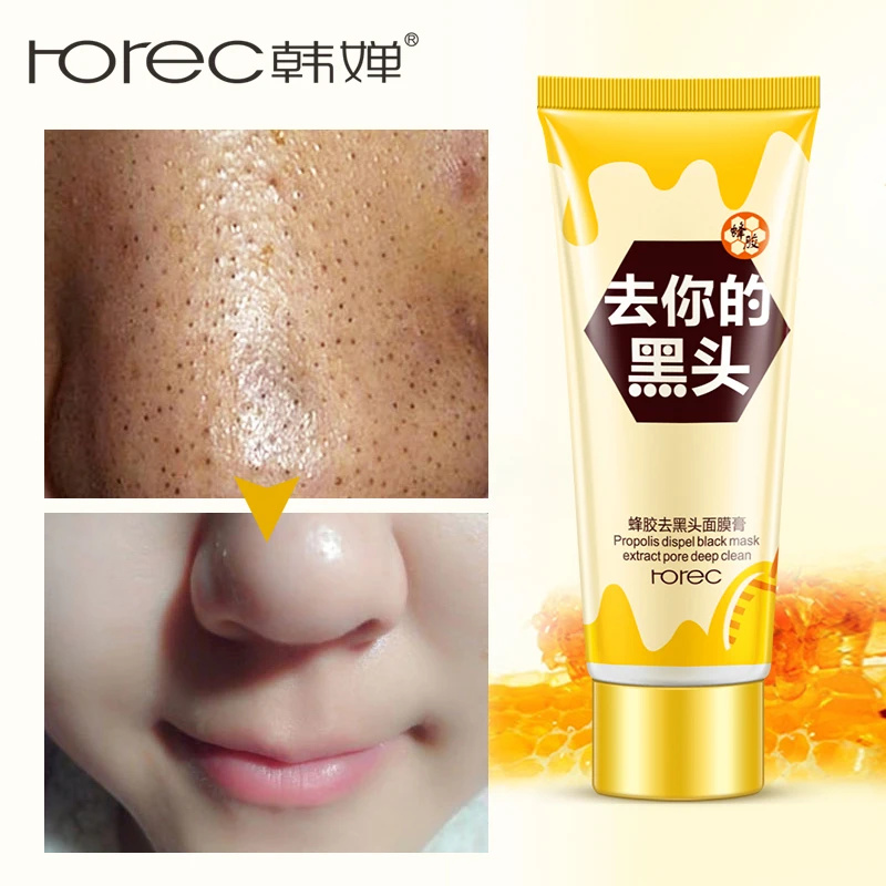 

ROREC Blackhead Remover Face & Nose Mask Purifying Pore Strip Peeling Acne Treatment Black Deep Cleansing Propolis Skin Care
