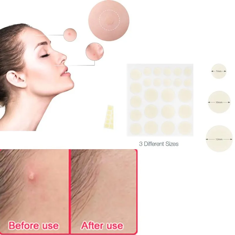 

2018 Skin Care Masks Invisible Acne Pimple Master Patches Set 24pcs/48pcs/72pcs Acne Stickers Acne Pimple Treatment Dropshipping
