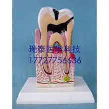 12*11*20 см медицинская научная зубная модель патологические зубы стоматологические кариес зубная Дека полости рта учебная форма