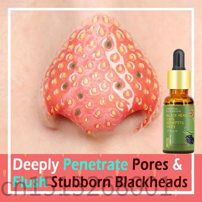 Антибактериальная сыворотка Blackhead эссенция для удаления очищает кожу примесей