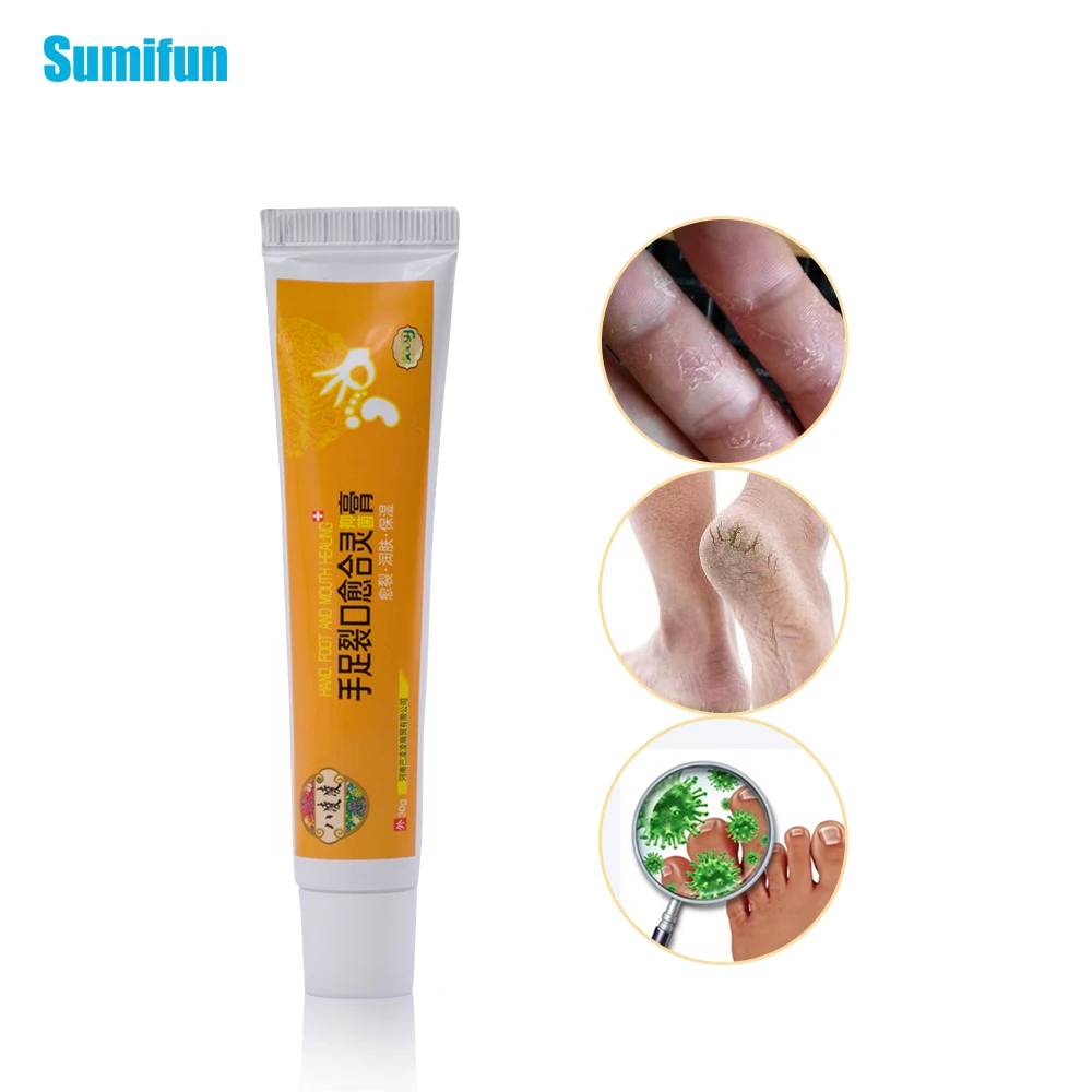 

Sumifun 1Pcs Soft Ointment Hand Foot Crack Cream Heel Chapped Peeling Repair Frostbite Anti Dry Crack Skin Care P1009