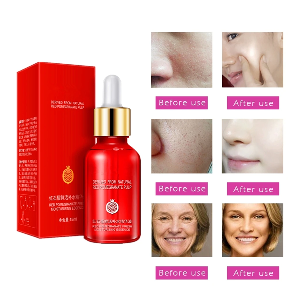 

Anti allergy Cosmetics Nature Pomegranate Scar repair Serum Skin Care Acne treatment Essence Anti Wrinkle Essence 15ml/bottle
