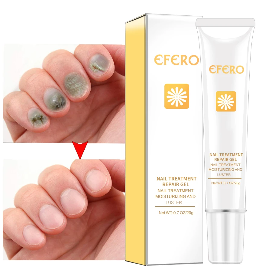 5PCS EFERO Nail Treatment Remedy for Nails Foot Fungus Nail Manicure Protector for Cuticle
