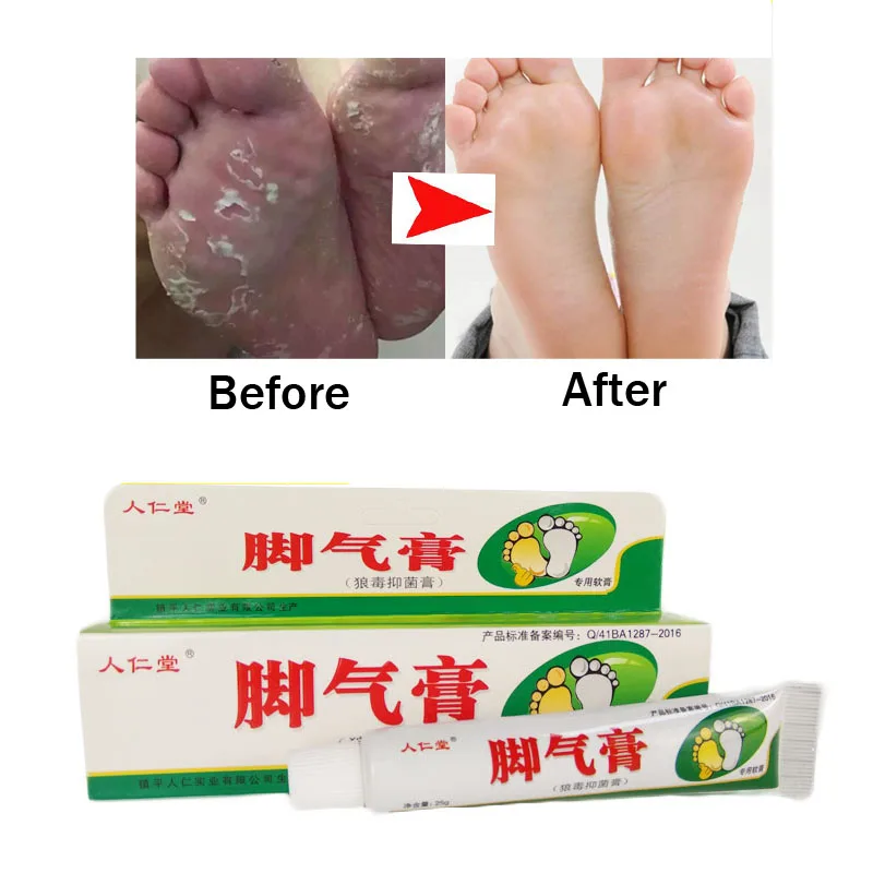 3pcs Foot Odor New Generation Smelly And Sweaty Feet Cure Itchy Cream