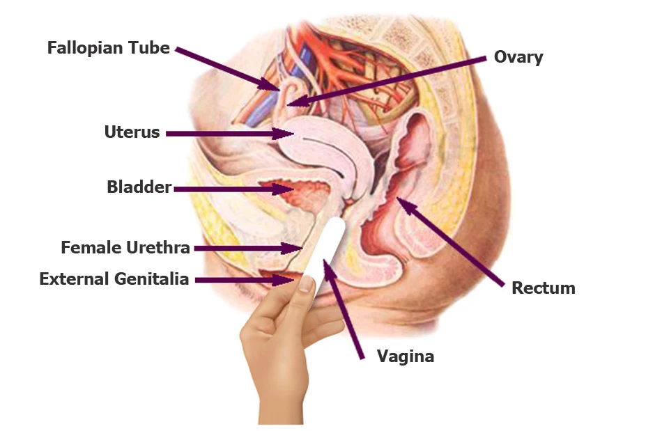 15_vaginal_tightening