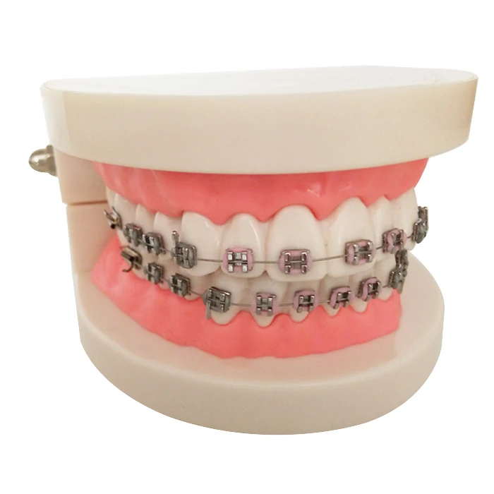

2017 Orthodontics Model for Dentist Dental 1/2 Standard Dentition with Brackets Teeth Model
