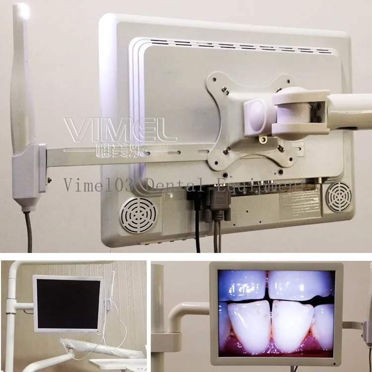 Идеальное сочетание орального стоматологического эндоскопа бороскопа и 17 дюймов монитор блок ТВ/ЖК-Интерфейс камеры зубы фотосессии