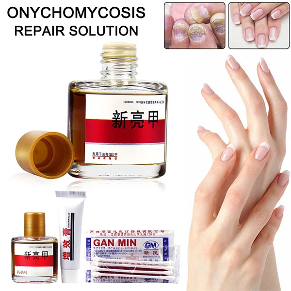 Nail Fungal Treatment Set Onychomycosis Removal Anti Fungus Toenail Nails Care Repair Liquid 25ml HJL2018