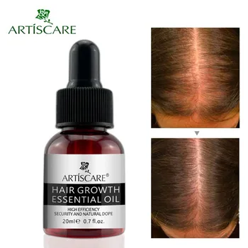 

Fast Powerful Hair Growth Essence Hair Loss Products Essential Oil Liquid Treatment Preventing Hair Loss Hair Care Products 20ml
