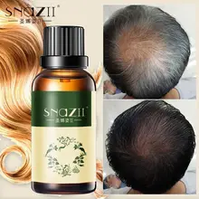 SNAZII эссенция для роста волос жидкость для выпадения волос густая быстро расти волосы натуральные чистые оригинальные эфирные масла продукт для восстановления роста