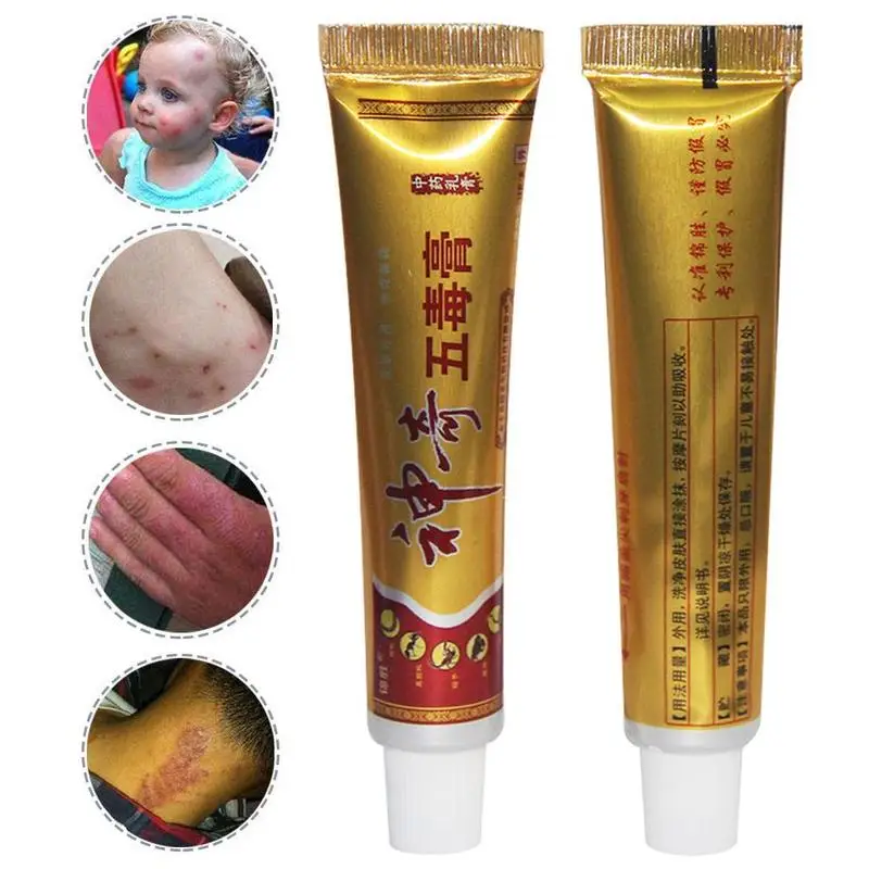 1PCS China Herbal Ointment Treatment Psoriasis Dermatitis Eczema Pruritus Skin Care Cream With Box 15g 1PCS China Herbal Ointment Treatment Psoriasis Dermatitis Eczema Pruritus Skin Care Cream With Box 15g