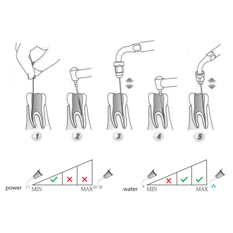 Dentista Dental Endo Tip 3 шт. ED2 для ультразвукового Sclaer и DTE передних зубов оборудование