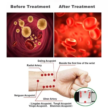 

Weber Medical Bestseller Laser Watch Therapy Tinnitus Device Medical Therapeutic Laser Blood Pressure Watch Laser