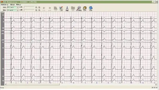 CONTEC8000G Многофункциональный ПК ECG/EKG рабочая станция система 12 свинец отдыха ECG