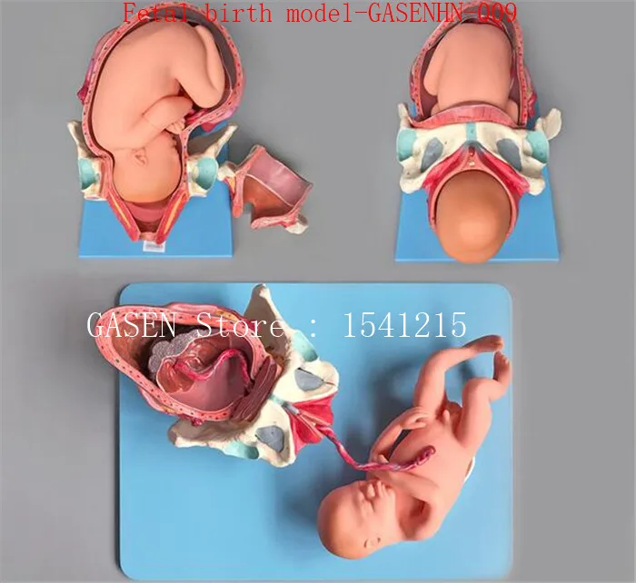 Срок поставки плода беременность роды акушерство обучение гинекология беременной октября плода рождения model-GASENHN-009