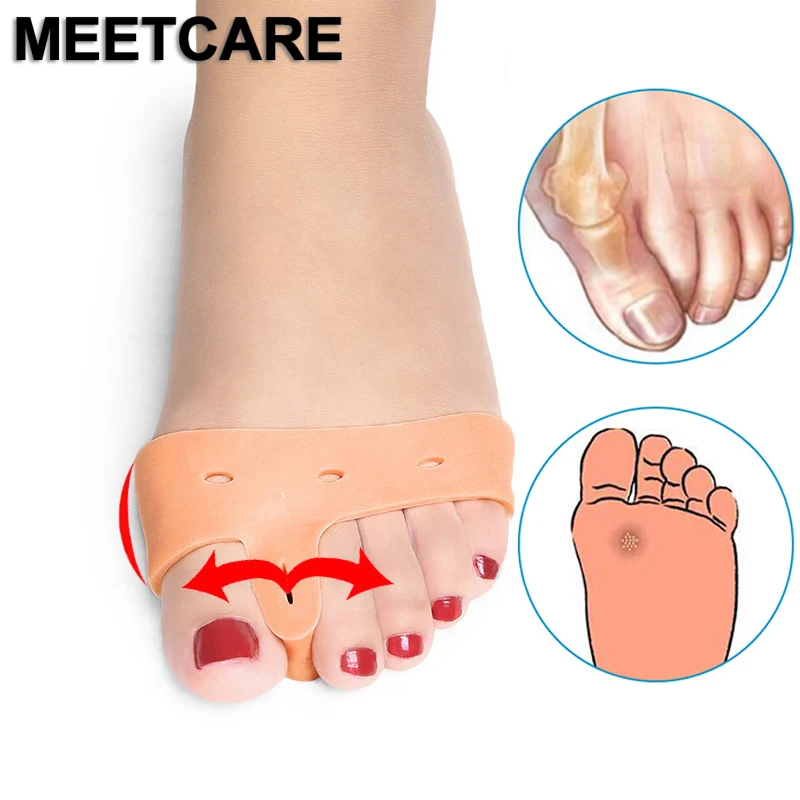 1Pair Hallux Valgus Orthotics Insoles Toe Separator Insole Toe