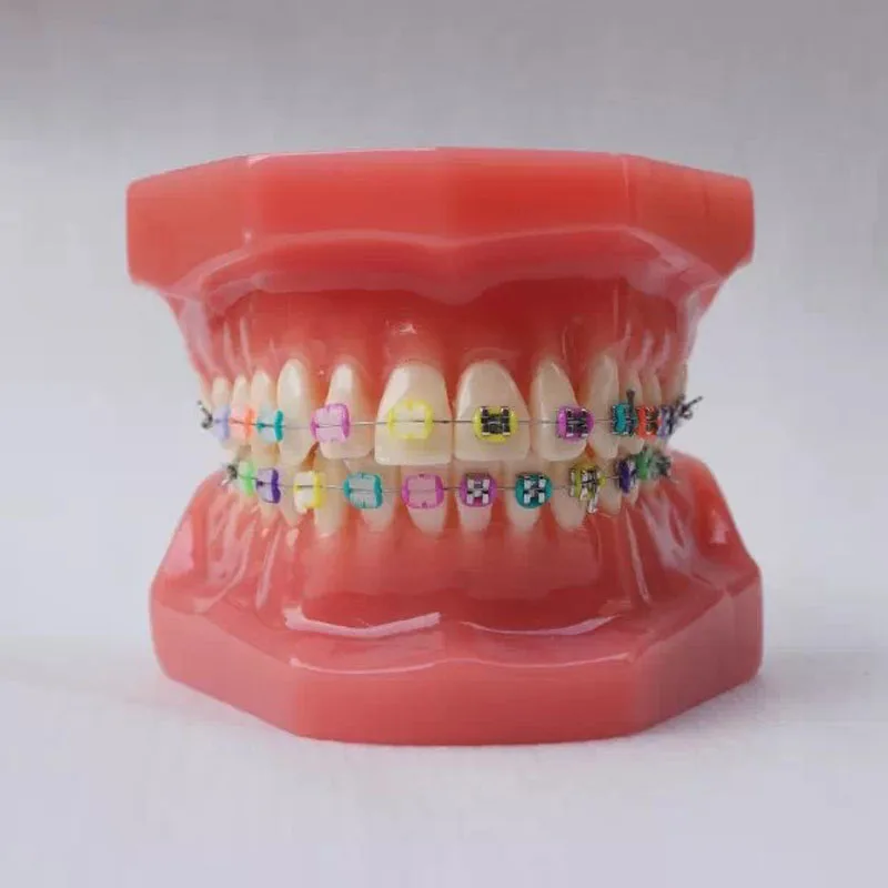 

28pcs Teeth Dental Orthodontics Tooth Model with half metal and half ceramic bracket