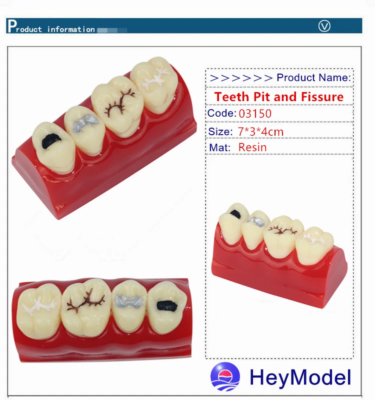 Heymodel зубы ямы и трещины Модель Стоматологическая dentition модель