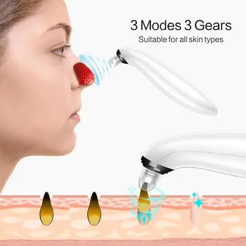 

Blackhead Remover Skin Care Deep Pore Cleaner Acne Pimple Removal Suction Tool Facial Beauty Face Clean Machine