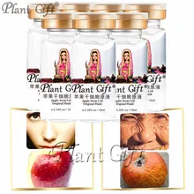10ml*7pcs plant gift Apple Stem Cell Original Fluid Skin Pigmentation Treatment Remove Freckle face care oral pigmentation