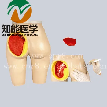 

BIX-H4T Advanced Hip Muscle Injection And Anatomical Structure Model