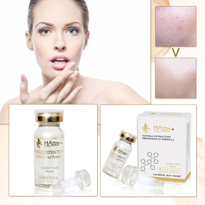 Azelaic Acid Serum For Face Acne Treatment Best Oil Control Skin Care Essence For Large Pores Before And After Effect Azelaic Acid Serum For Face Acne Treatment Best Oil Control Skin Care Essence For Large Pores Before And After Effect