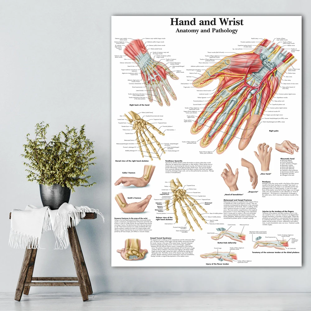 Online Anatomie Hand Handgelenk Bilder Anatomischen Charts Poster Anatomie Arm Bein Leinwand Druck Wand Bilder Medizinische Bildung Office Home