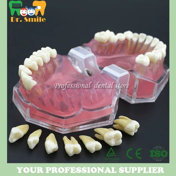 

Dental Soft Gum Standad Typodont Study Model with 28pcs Removable Teeth #7008
