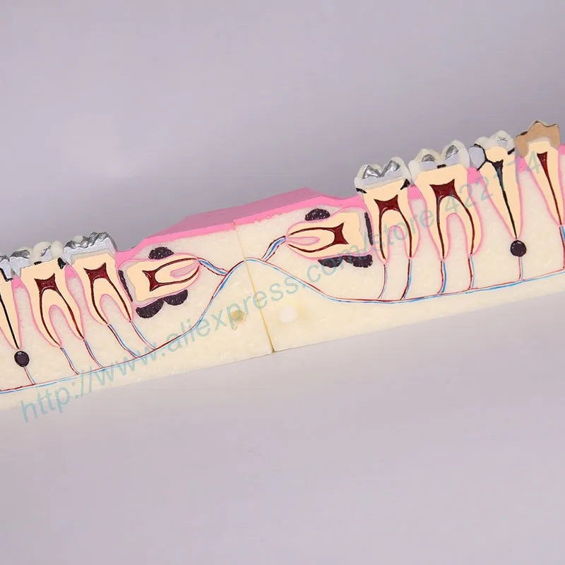 Molar cross section study model 04
