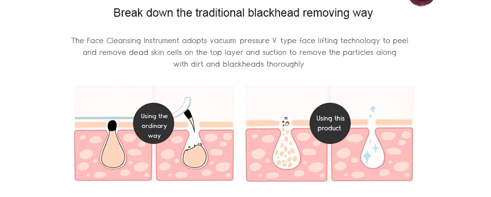 Blackhead instrument pore cleaner to blackhead artifact electric acne machine to blackhead allinonehere.com