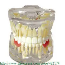 Typodont Ортодонтическое лечебное масло для ногтей зубной зуб зубы стоматолог стоматология анатомическая анатомия модель одонтология