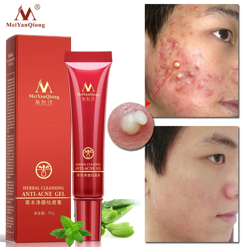 Face Acne Cleaning Cream Skin Care Remove Repair Comedone Pimple Acne