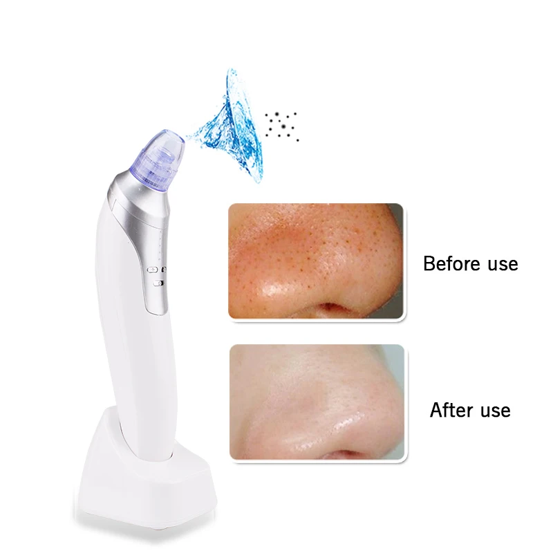 Skin Care Pore Vacuum Blackhead Remover Facial Vacuum Pore Cleaner Nose Acne Blackhead Suction