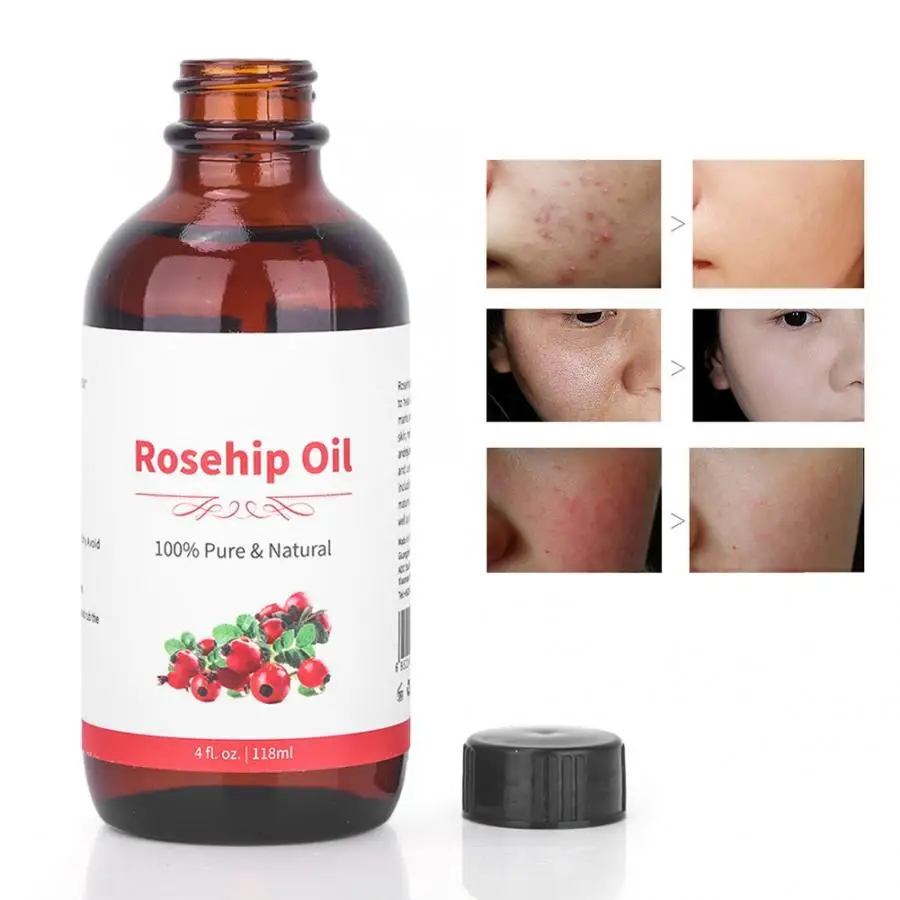 

118ml Rosehip Oil Massage Essential Oil Moisturizing SPA Aromatherapy Body Massage Oil Skin Care