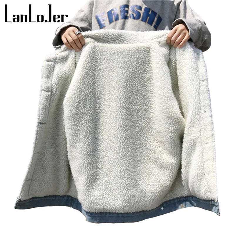 148
