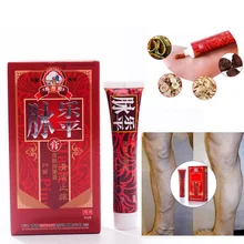 Лечение Варикозного расширения вен мазь васкулит флебит СПАЙДЕР вены боль варикоза ангиит средство удаление травяной первой помощи