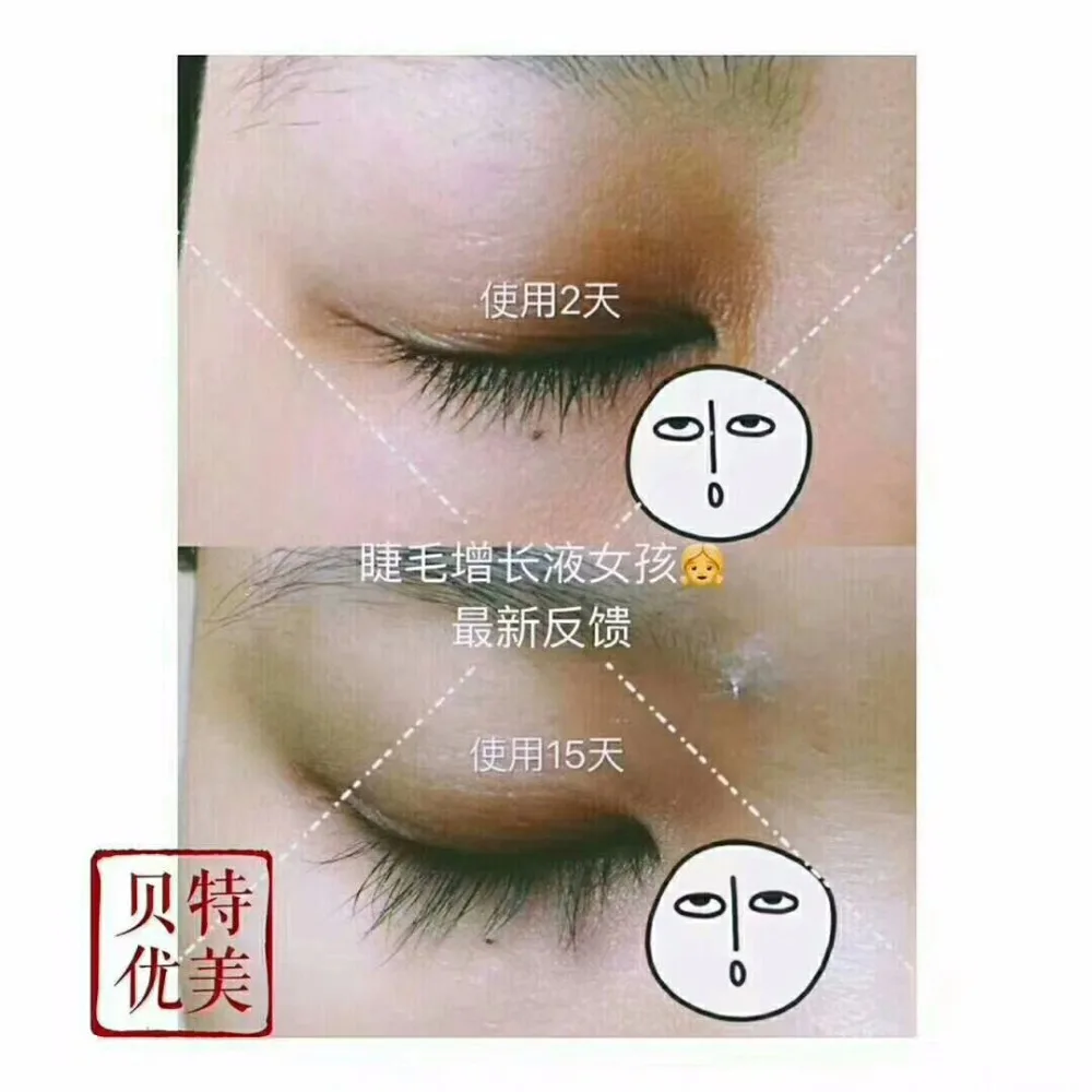 mmexport1522471628397