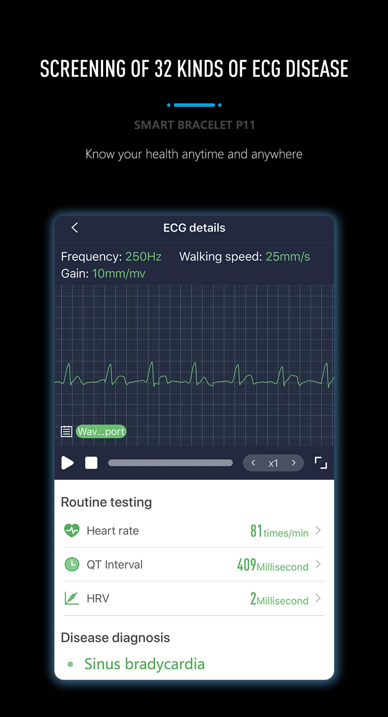 MKS смарт-браслет PPG ECG HRV кровяное давление пульсометр фитнес-браслет трекер активности браслет для здоровья для Android ios